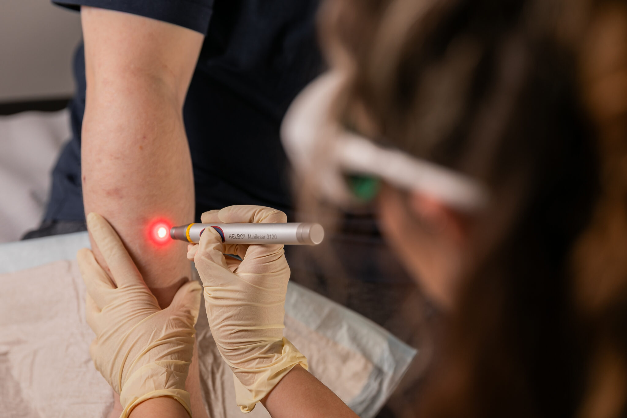 Wundmanagerin bei der Lasertherapie einer kleinen Wunde